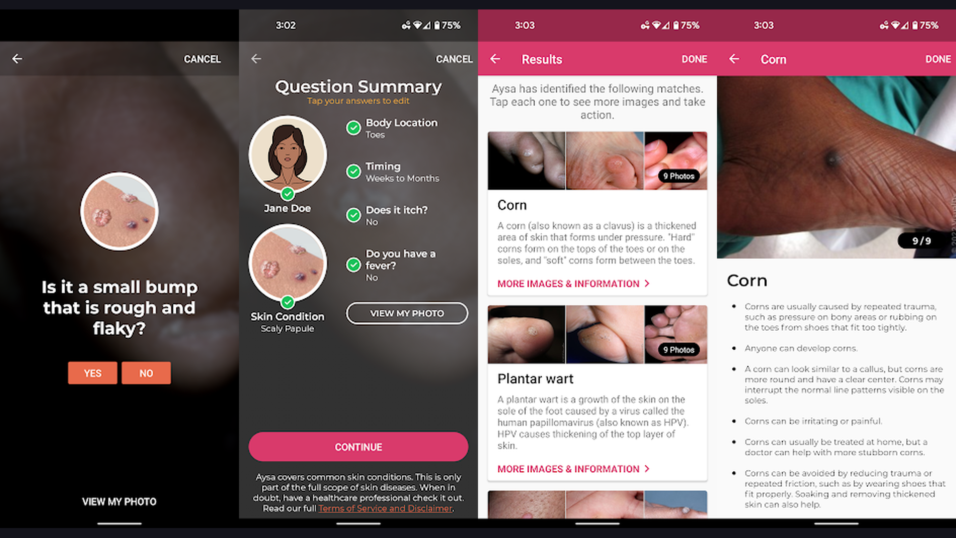 VisualDx diagnostic app screenshots